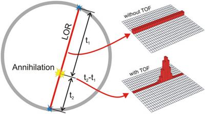 State-of-the-art challenges and emerging technologies in radiation detection for nuclear medicine imaging: A review